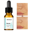 SkinEase™ | Naaldloos serum